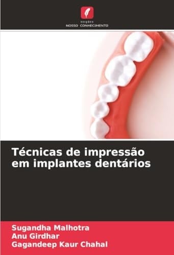 Técnicas de impressão em implantes dentários (Portuguese Edition)