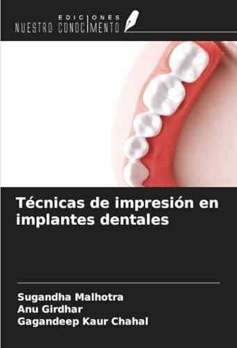 Técnicas de impresión en implantes dentales (Spanish Edition)