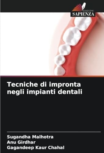 Tecniche di impronta negli impianti dentali (Italian Edition)