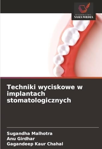 Techniki wyciskowe w implantach stomatologicznych (Polish Edition)