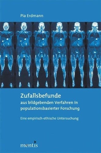 Zufallsbefunde Aus Bildgebenden Verfahren in Populationsbasierter Forschung: Eine Empirisch-Ethische Untersuchung (German Edition)