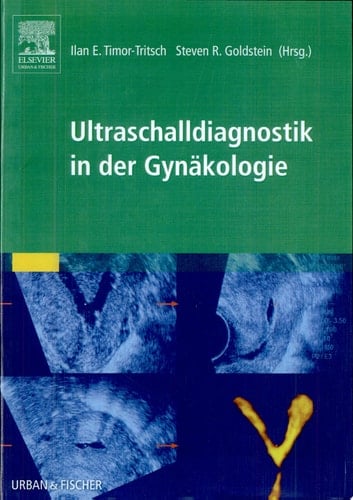 Ultraschalldiagnostik in der Gynäkologie
