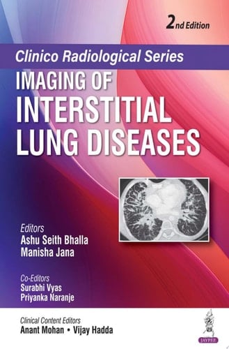 Clinico Radiological Series: Imaging of Interstitial Lung Diseases