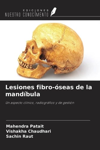 Lesiones fibro-óseas de la mandíbula: Un aspecto clínico, radiográfico y de gestión (Spanish Edition)