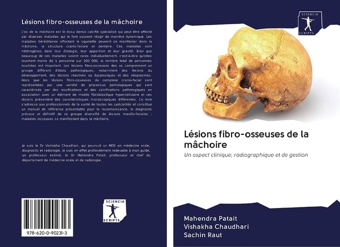 Lésions fibro-osseuses de la mâchoire: Un aspect clinique, radiographique et de gestion (French Edition)