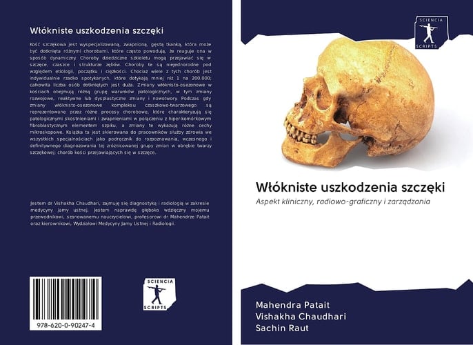 Włókniste uszkodzenia szczęki: Aspekt kliniczny, radiowo-graficzny i zarządzania (Polish Edition)