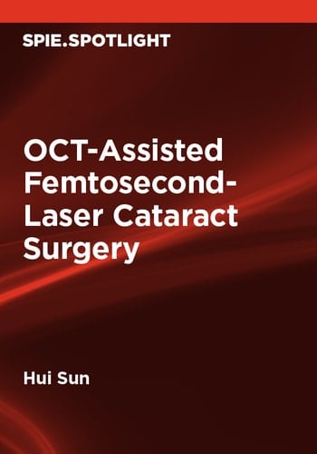 OCT-Assisted Femtosecond-Laser Cataract Surgery