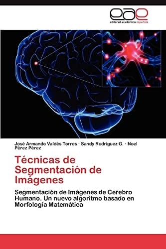 Técnicas de Segmentación de Imágenes