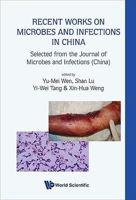 Recent Works on Microbes and Infections in China Selected from the Journal of Microbes and Infections (China)
