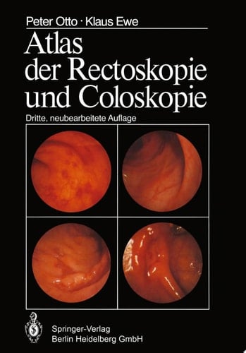 Atlas der Rectoskopie und Coloskopie
