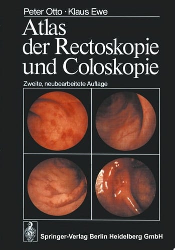 Atlas der Rectoskopie und Coloskopie