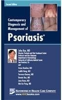 Contemporary Diagnosis and Management of Psoriasis