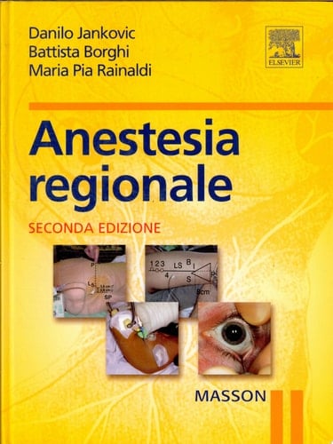 Anestesia regionale