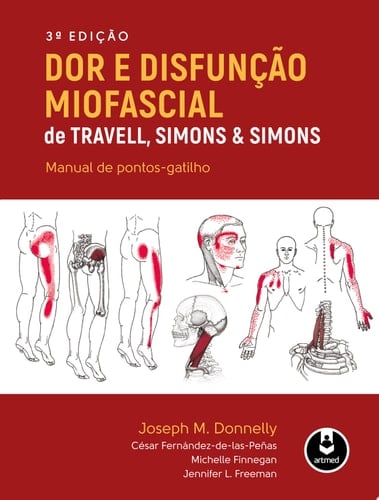 Dor e Disfunção Miofascial de Travell, Simons & Simons - 3.ed. Manual de Pontos-Gatilho