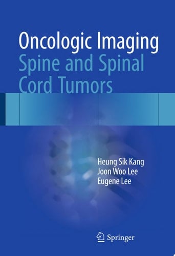 Oncologic Imaging: Spine and Spinal Cord Tumors
