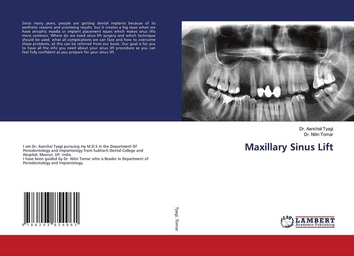 Maxillary Sinus Lift