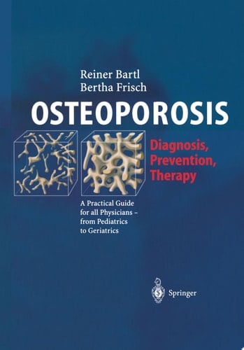 OSTEOPOROSIS Diagnosis, Prevention, Therapy