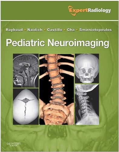 Pediatric Neuroimaging: Expert Radiology Series