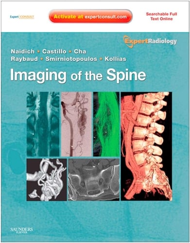 Imaging of the Spine