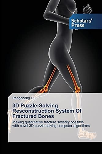 3D Puzzle-Solving Resconstruction System Of Fractured Bones: Making quantitative fracture severity possible with novel 3D puzzle-solving computer algorithms