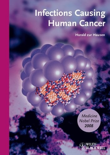 Infections Causing Human Cancer Softcover Edition