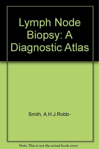 Lymph Node Biopsy