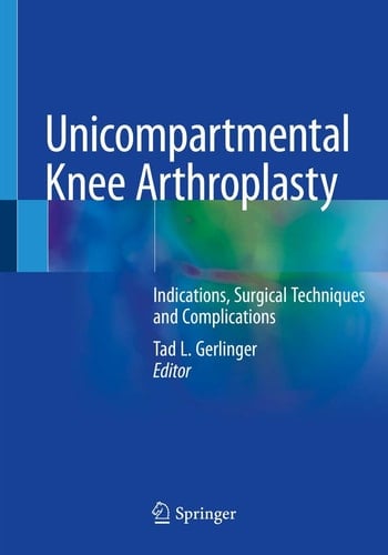 Unicompartmental Knee Arthroplasty Indications, Surgical Techniques and Complications