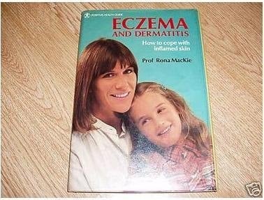 Eczema and Dermatitis : how to Cope with Inflamed Skin