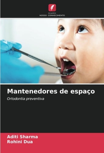 Mantenedores de espaço: Ortodontia preventiva (Portuguese Edition)