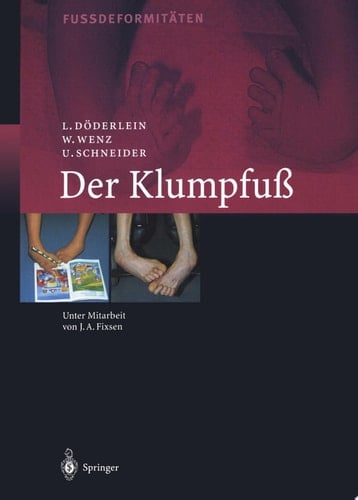 Der Klumpfuss Erscheinungsformen und Behandlungsprinzipien jeden Alters. Differentialdiagnose und Differentialtherapie