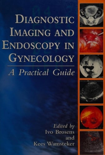 Diagnostic Imaging and Endoscopy in Gynecology: A Practical Guide