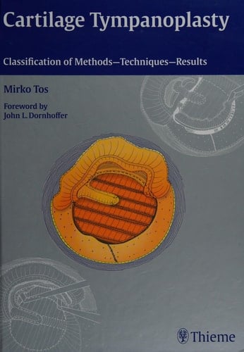 Cartilage Tympanoplasty