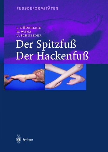 Fussdeformitäten Der Spitzfuss/Der Hackenfuss