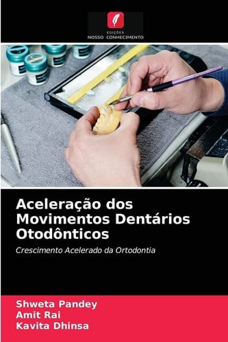 Aceleração dos Movimentos Dentários Otodônticos: Crescimento Acelerado da Ortodontia (Portuguese Edition)