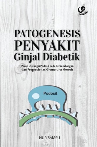 Patogenesis Penyakit Ginjal Diabetik Peran Disfungsi Podosit pada Perkembangan dan Progresivitas Glomerulosklerosis