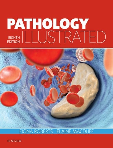 Pathology Illustrated