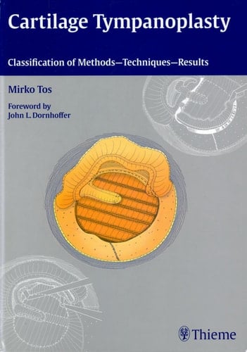 Cartilage Tympanoplasty Classification of Methods - Techniques - Results