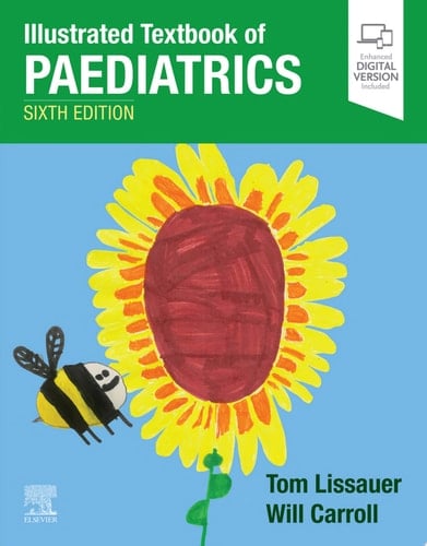Illustrated Textbook of Paediatrics E-Book Illustrated Textbook of Paediatrics E-Book