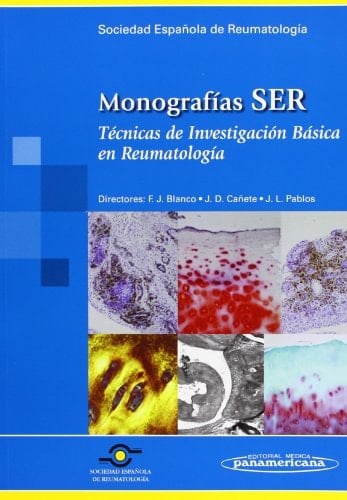 Monografía SER: Artritis infecciosa.