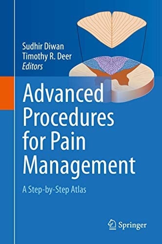 Advanced Procedures for Pain Management A Step-by-Step Atlas