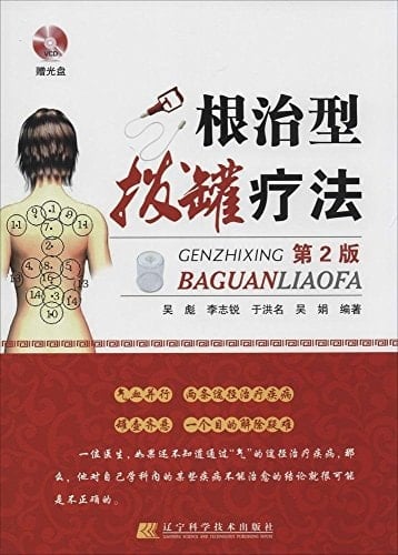 Radical type cupping therapy (2nd Edition) (gift CD)(Chinese Edition)