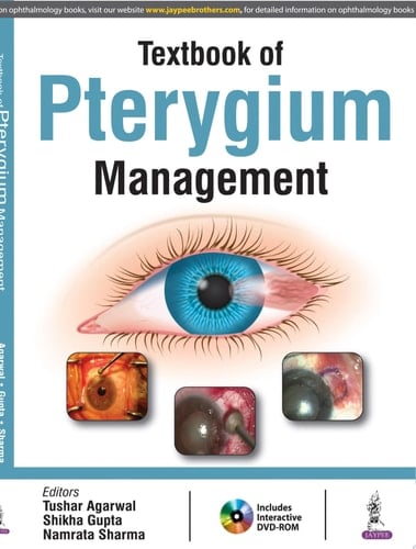 Textbook of Pterygium Management