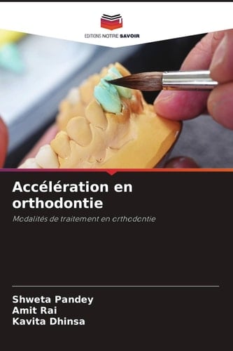 Accélération en orthodontie: Modalités de traitement en orthodontie (French Edition)