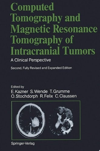 Computed Tomography and Magnetic Resonance Tomography of Intracranial Tumors A Clinical Perspective