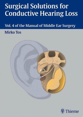 Surgical Solutions for Conductive Hearing Loss Vol. 4 of the Manual of Middle Ear Surgery