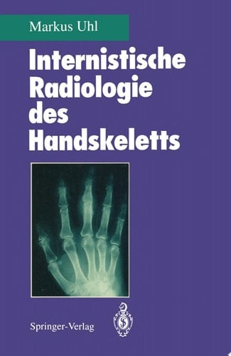 Internistische Radiologie des Handskeletts