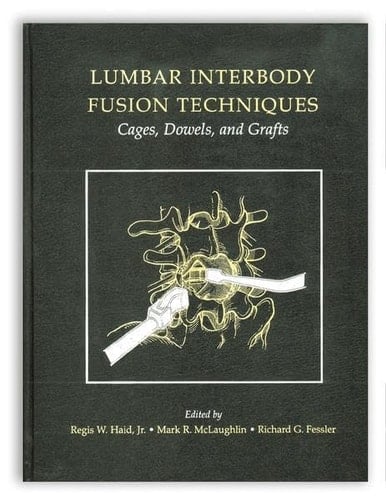 Lumbar Interbody Fusion Techniques: Cages, Dowels, and Grafts