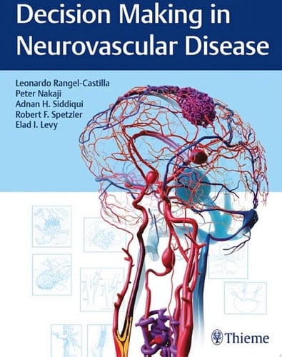 Decision Making in Neurovascular Disease