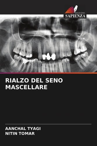RIALZO DEL SENO MASCELLARE (Italian Edition)