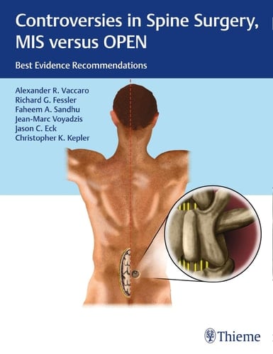 Controversies in Spine Surgery, MIS Versus OPEN Best Evidence Recommendations